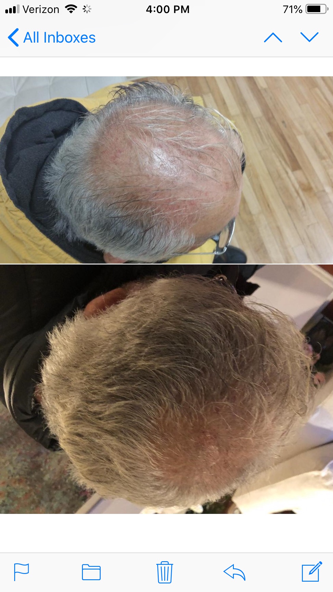 Before and After Results